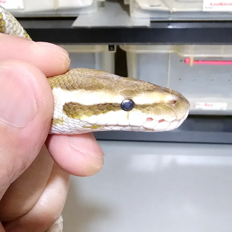 Heterochromia
